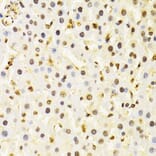 Immunohistochemistry - Anti-Cullin 4B / CUL-4B Antibody (A14734) - Antibodies.com