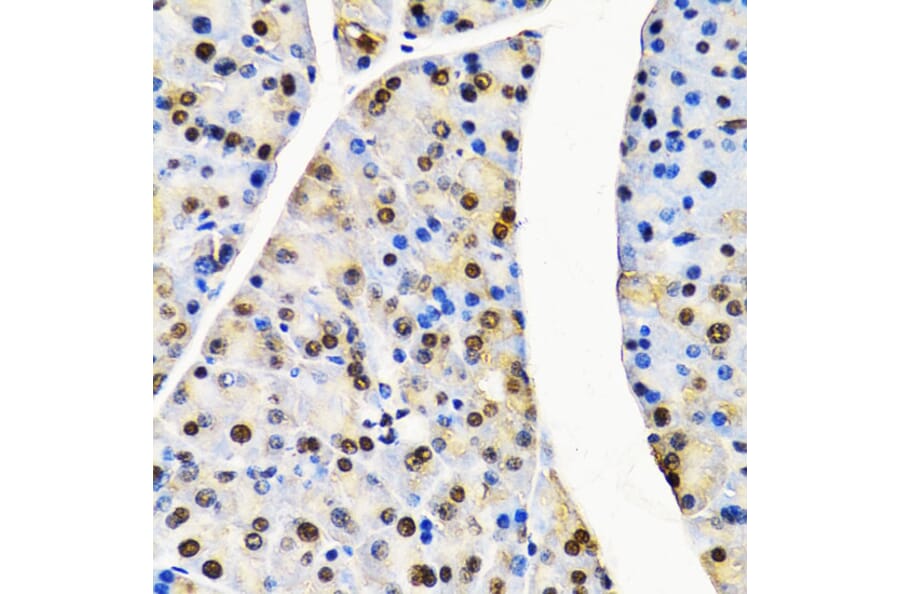 Immunohistochemistry - Anti-Cullin 4B / CUL-4B Antibody (A14734) - Antibodies.com