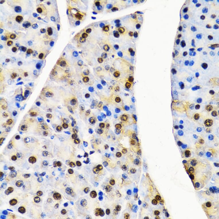 Immunohistochemistry - Anti-Cullin 4B / CUL-4B Antibody (A14734) - Antibodies.com