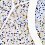 Immunohistochemistry - Anti-Cullin 4B / CUL-4B Antibody (A14734) - Antibodies.com