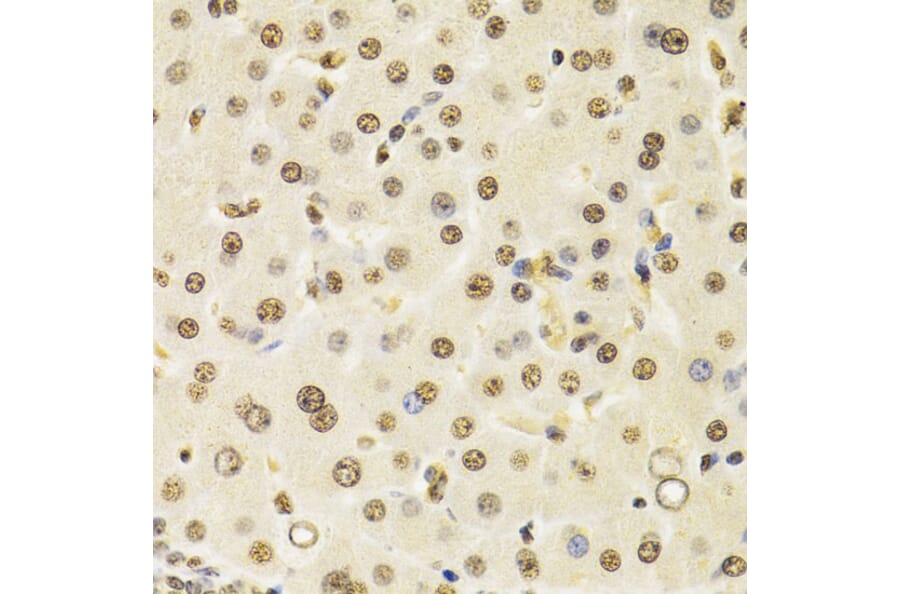 Immunohistochemistry - Anti-Cullin 4B / CUL-4B Antibody (A14734) - Antibodies.com