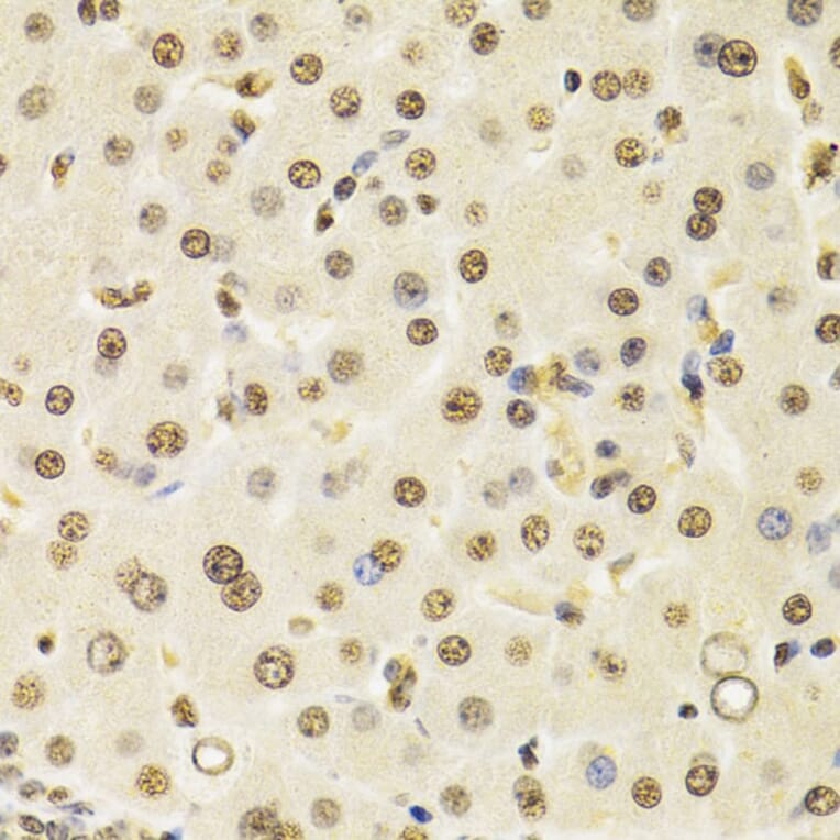 Immunohistochemistry - Anti-Cullin 4B / CUL-4B Antibody (A14734) - Antibodies.com