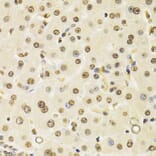 Immunohistochemistry - Anti-Cullin 4B / CUL-4B Antibody (A14734) - Antibodies.com