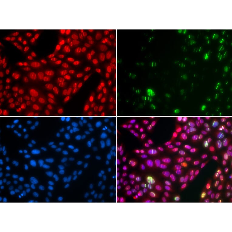Immunofluorescence - Anti-Cullin 4B / CUL-4B Antibody (A14734) - Antibodies.com