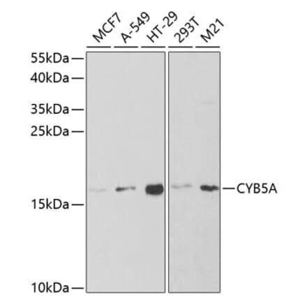 Western Blot - Anti-Cytochrome b5 Antibody (A14735) - Antibodies.com