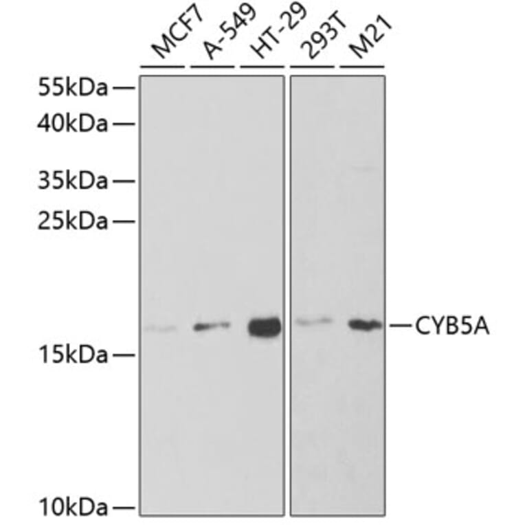 Western Blot - Anti-Cytochrome b5 Antibody (A14735) - Antibodies.com