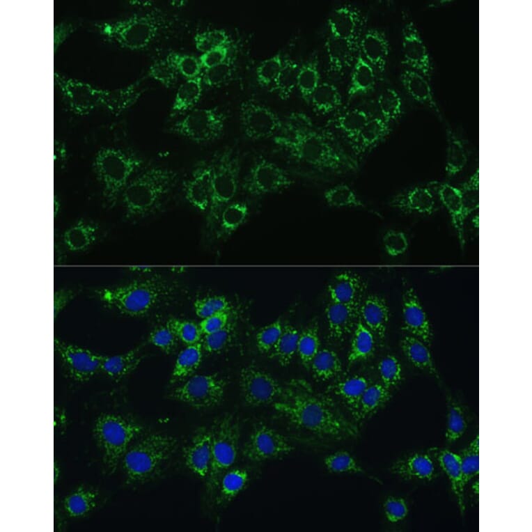Immunofluorescence - Anti-Cytochrome b5 Antibody (A14735) - Antibodies.com