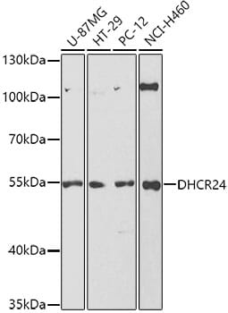 Western blot analysis of extracts of various cell lines, using Anti-DHCR24 Antibody (A5402) at 1:1,000 dilution.
Secondary antibody: Goat Anti-Rabbit IgG (H+L) (HRP) (AS014) at 1:10,000 dilution.
Lysates / proteins: 25µg per lane.
Blocking buffer: 3% non-fat dry milk in TBST.
Detection: ECL Basic Kit (RM00020).
Exposure time: 180s.