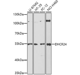 Western Blot - Anti-Seladin 1 Antibody (A14736) - Antibodies.com