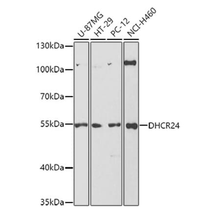 Western Blot - Anti-Seladin 1 Antibody (A14736) - Antibodies.com