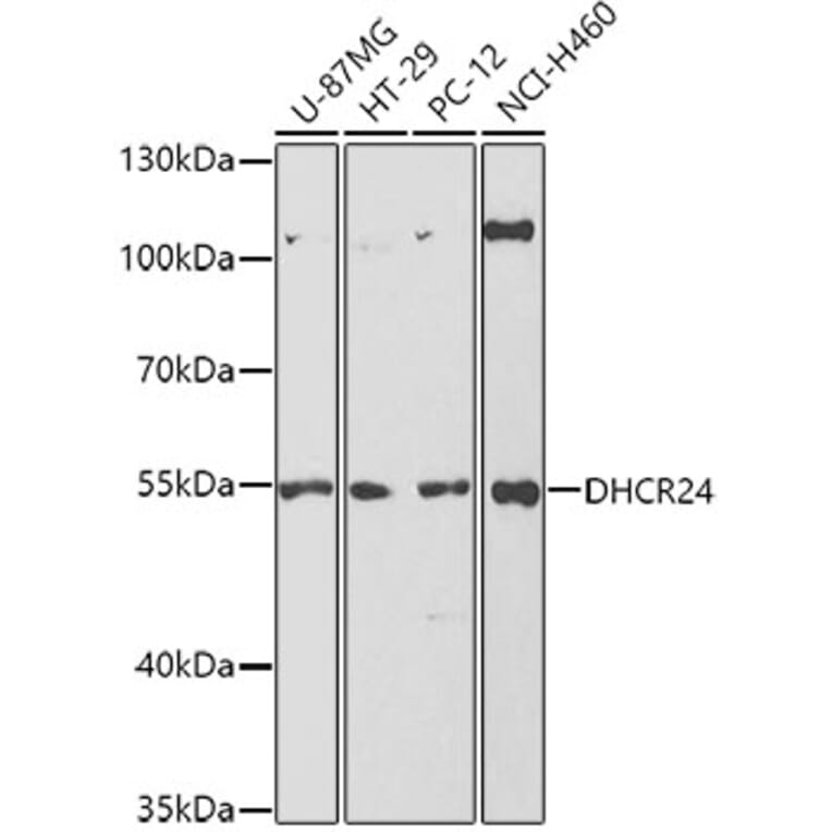 Western Blot - Anti-Seladin 1 Antibody (A14736) - Antibodies.com