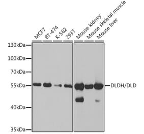 Western Blot - Anti-Lipoamide Dehydrogenase Antibody (A14737) - Antibodies.com
