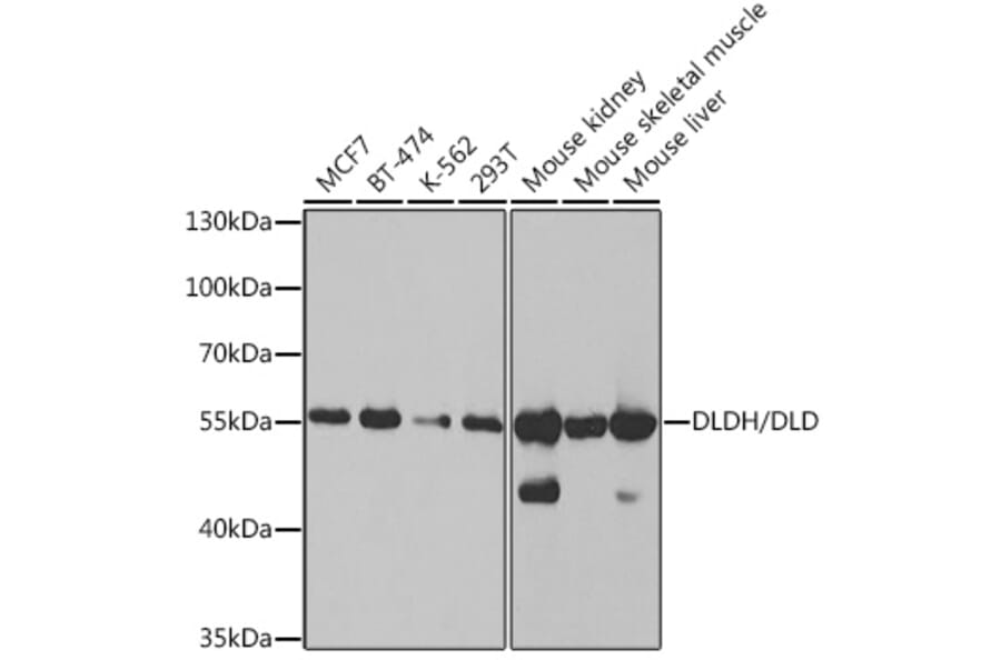 Western Blot - Anti-Lipoamide Dehydrogenase Antibody (A14737) - Antibodies.com