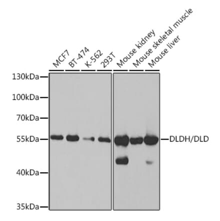 Western Blot - Anti-Lipoamide Dehydrogenase Antibody (A14737) - Antibodies.com