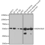 Western Blot - Anti-Lipoamide Dehydrogenase Antibody (A14737) - Antibodies.com