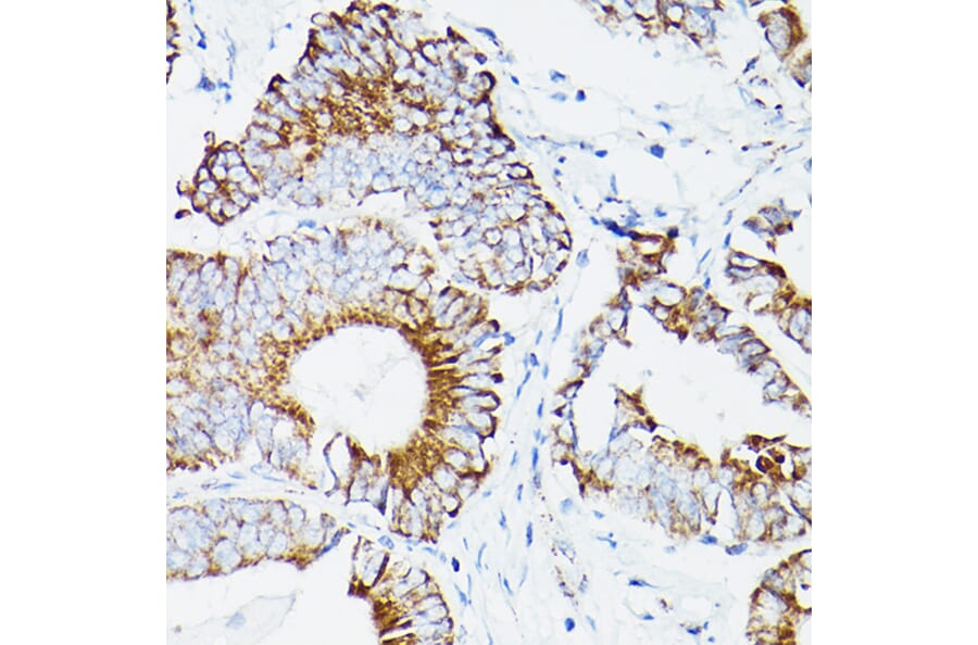 Immunohistochemistry - Anti-Lipoamide Dehydrogenase Antibody (A14737) - Antibodies.com