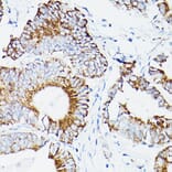 Immunohistochemistry - Anti-Lipoamide Dehydrogenase Antibody (A14737) - Antibodies.com