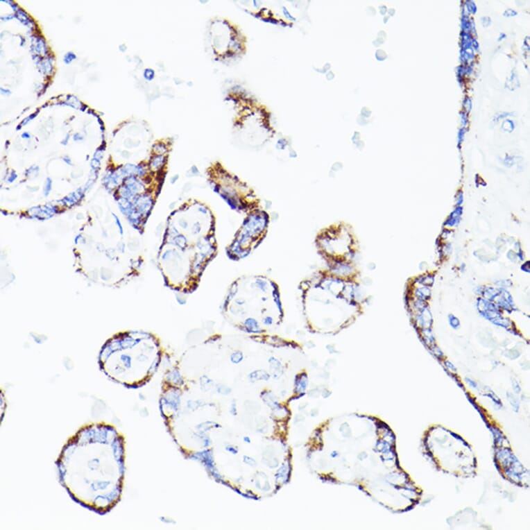 Immunohistochemistry - Anti-Lipoamide Dehydrogenase Antibody (A14737) - Antibodies.com