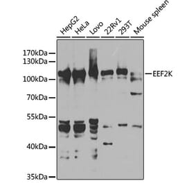 Western Blot - Anti-EEF2K Antibody (A14738) - Antibodies.com