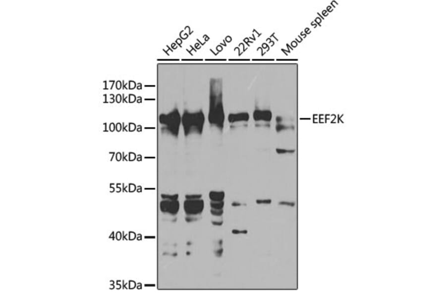 Western Blot - Anti-EEF2K Antibody (A14738) - Antibodies.com