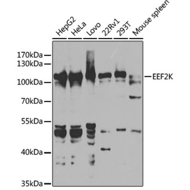 Western Blot - Anti-EEF2K Antibody (A14738) - Antibodies.com