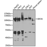 Western Blot - Anti-EEF2K Antibody (A14738) - Antibodies.com