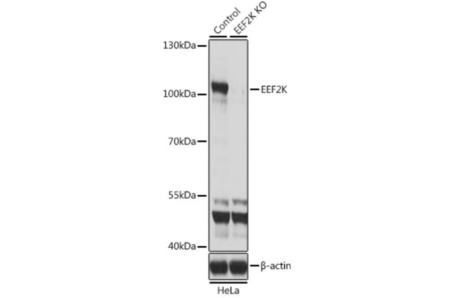 Western Blot - Anti-EEF2K Antibody (A14738) - Antibodies.com