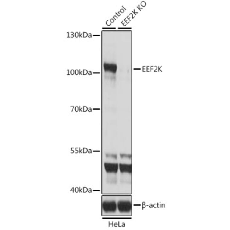 Western Blot - Anti-EEF2K Antibody (A14738) - Antibodies.com