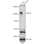 Western Blot - Anti-EEF2K Antibody (A14738) - Antibodies.com