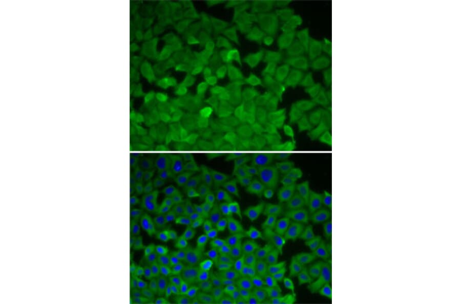 Immunofluorescence - Anti-EEF2K Antibody (A14738) - Antibodies.com