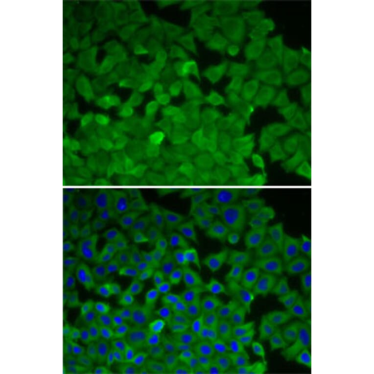 Immunofluorescence - Anti-EEF2K Antibody (A14738) - Antibodies.com