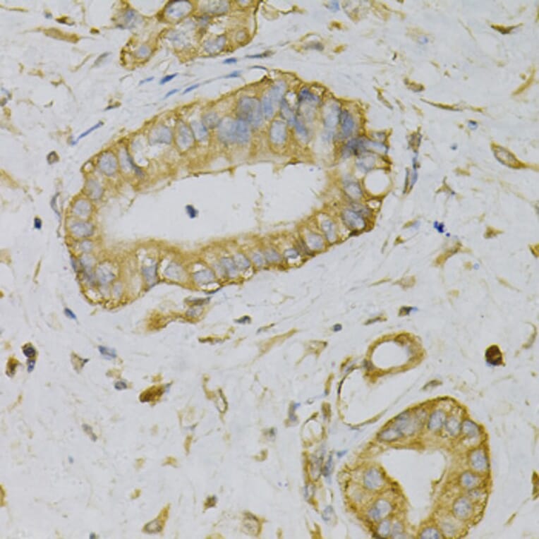 Immunohistochemistry - Anti-EIF4B Antibody (A5405) - Antibodies.com