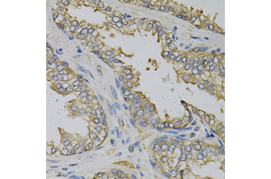 Immunohistochemistry - Anti-EIF4B Antibody (A5405) - Antibodies.com