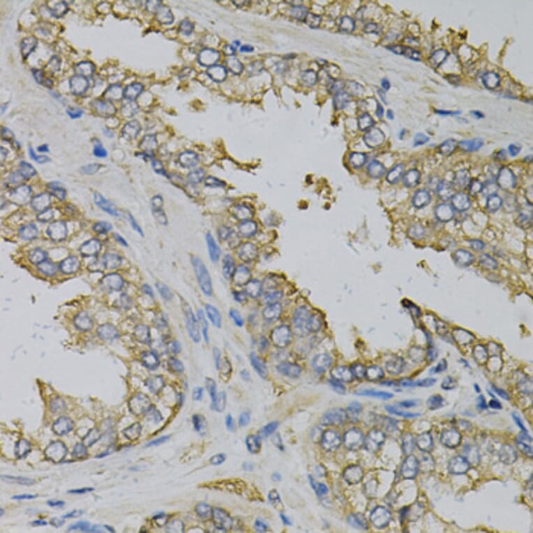 Immunohistochemistry - Anti-EIF4B Antibody (A5405) - Antibodies.com