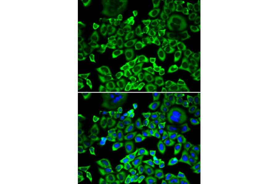 Immunofluorescence - Anti-EIF4B Antibody (A5405) - Antibodies.com
