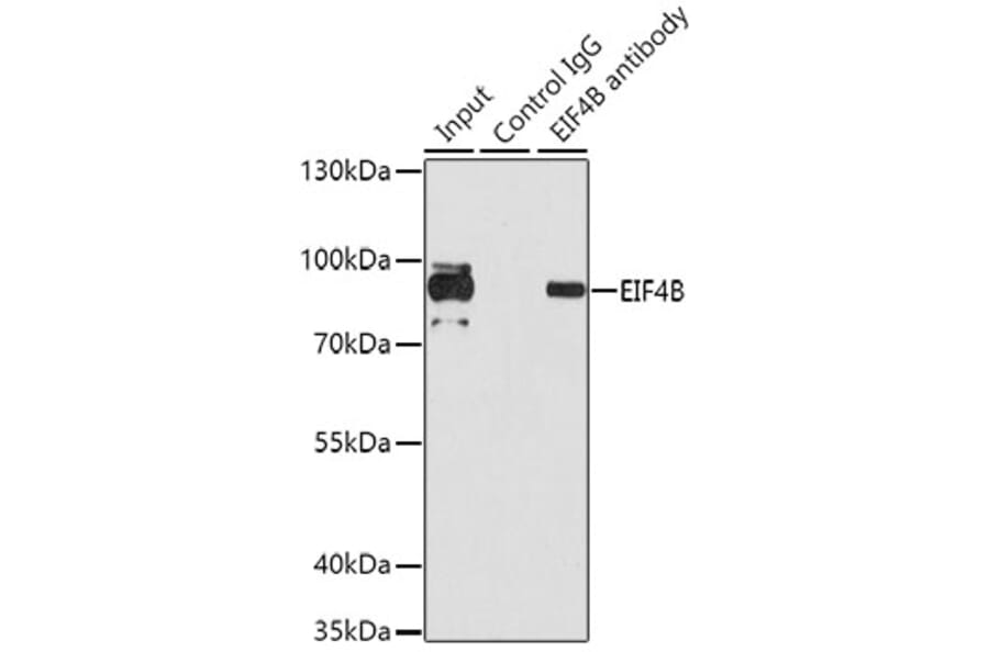 Immunoprecipitation - Anti-EIF4B Antibody (A5405) - Antibodies.com
