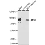 Immunoprecipitation - Anti-EIF4B Antibody (A5405) - Antibodies.com