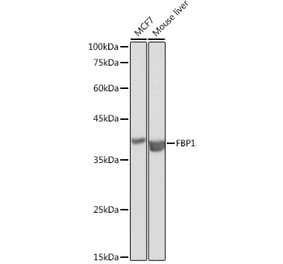 Western Blot - Anti-FBP1 Antibody (A14740) - Antibodies.com