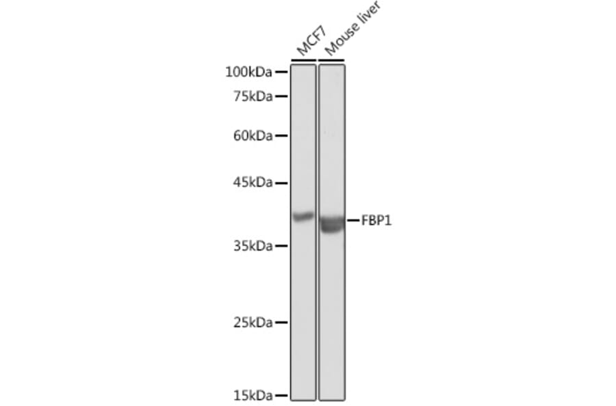 Western Blot - Anti-FBP1 Antibody (A14740) - Antibodies.com