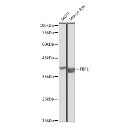 Western Blot - Anti-FBP1 Antibody (A14740) - Antibodies.com