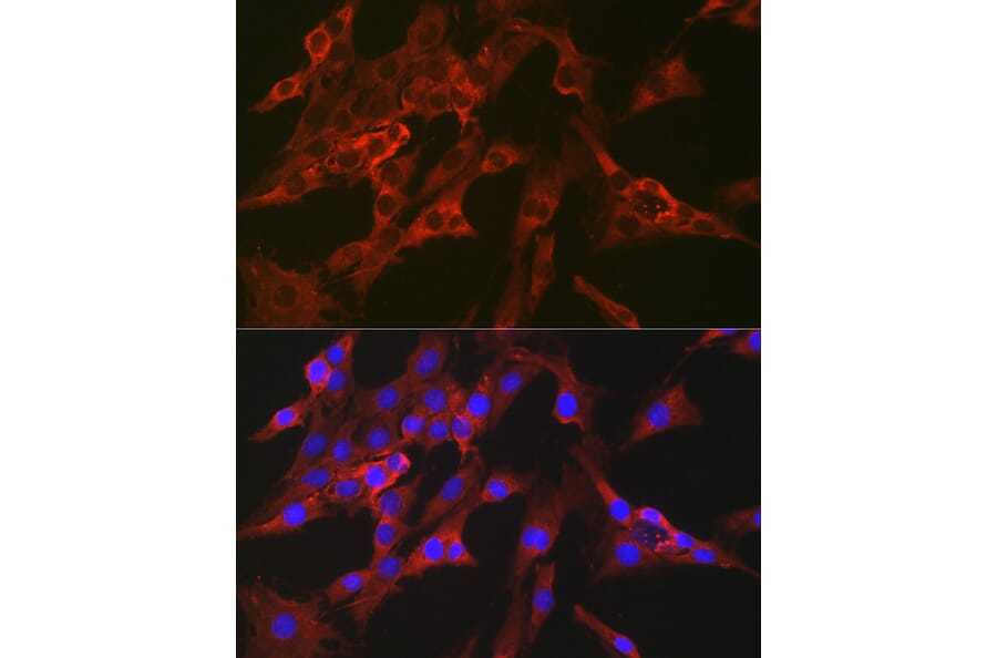 Immunofluorescence - Anti-FBP1 Antibody (A14740) - Antibodies.com