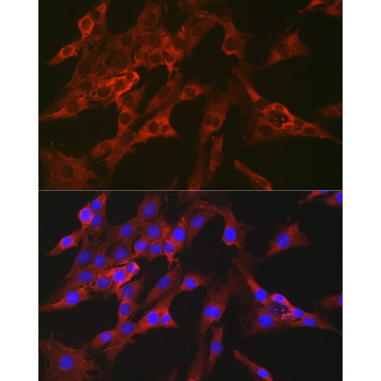 Immunofluorescence - Anti-FBP1 Antibody (A14740) - Antibodies.com