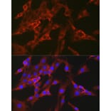 Immunofluorescence - Anti-FBP1 Antibody (A14740) - Antibodies.com