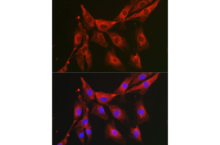 Immunofluorescence - Anti-FBP1 Antibody (A14740) - Antibodies.com