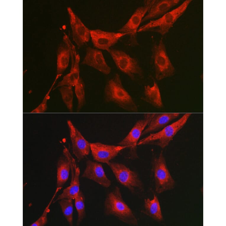 Immunofluorescence - Anti-FBP1 Antibody (A14740) - Antibodies.com