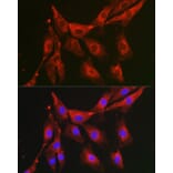Immunofluorescence - Anti-FBP1 Antibody (A14740) - Antibodies.com