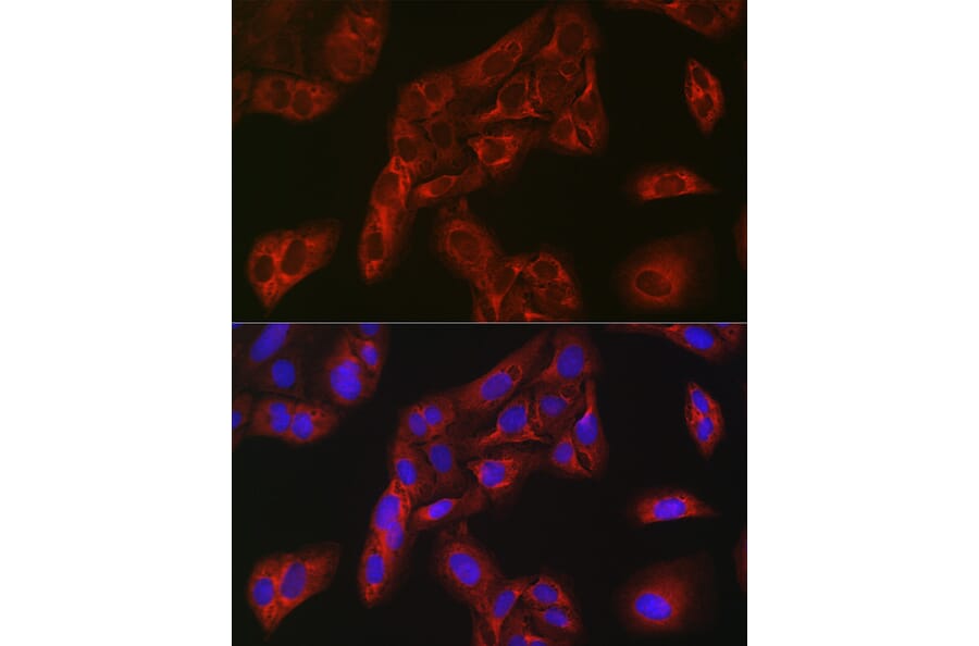 Immunofluorescence - Anti-FBP1 Antibody (A14740) - Antibodies.com