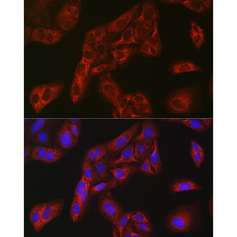Immunofluorescence - Anti-FBP1 Antibody (A14740) - Antibodies.com