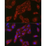 Immunofluorescence - Anti-FBP1 Antibody (A14740) - Antibodies.com