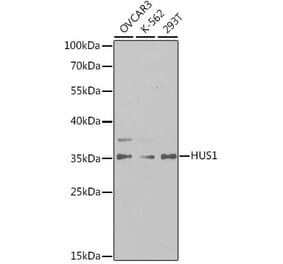 Western Blot - Anti-HUS1 Antibody (A14741) - Antibodies.com